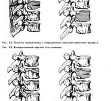 Klasifikacija poškodb hrbtenice in hrbtenjače