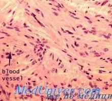 Cellular sestava hipotalamusa. Učinek hipoksije na celicah paraventricular in supraoptic jeder