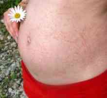 Kožni izpuščaji v nosečnosti