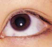 Meja keratitis oči: zdravljenje, vzroki, simptomi