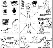 Laboratorijska diagnoza črevesne infestacije s helminti in protozoozov