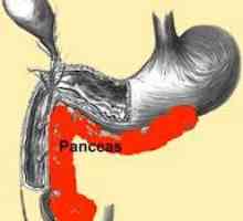 Zdravljenje vnetja trebušne slinavke (pankreasa) v akutni fazi