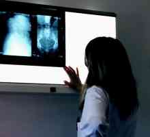 Zdravljenje v Španiji diagnostično slikanje center dr manchon barcelona