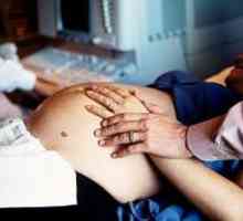 Listerioza v nosečnosti, simptomi, zdravljenje