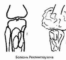 Sevanje in instrumentalne diagnoza kolenskega sklepa patologije. artritis