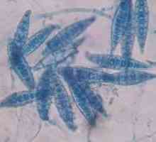 Microsporidiosis pri ljudeh: simptomi, zdravljenje