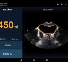 Miniaturni ultrazvok skener za urologi