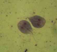 Lahko Giardia v urogenitalnega sistema povzročijo vnetje mehurja?