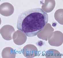 Monocytosis in limfocitoza. Sistem komplementa