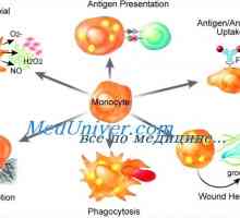 Disfunkcija monocitov in makrofagov imunitete