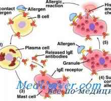 Dedni vzroki za alergije. genetika atopija