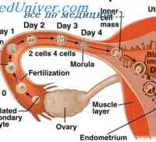 Nenormalno mesto implantacija zarodkov. Jajčnikov in trebuhu nosečnost