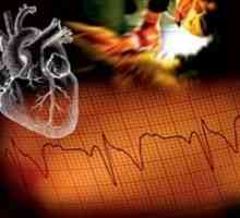 Nujni v kardiologijo: zdravljenje