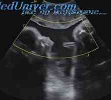 Pogovorite varnosti uporabe ultrazvoka. Vpliv ultrazvoka na tkivo