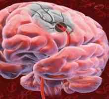 Možganski tumor in njegove membrane, ki vodijo k porazu vidni poti