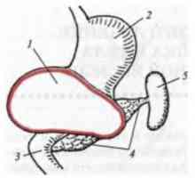 Značilnosti kirurško zdravljenje cist na ožine in telo trebušne slinavke