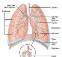 Akutni pljučni absces