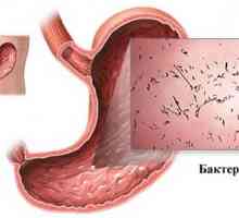 Akutna nalezljiva gastroenteritis