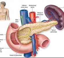 Akutni pankreatitis pri sladkorni bolezni