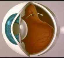 Odstop mrežnice oči: vzroki, simptomi, zdravljenje, simptomi
