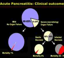 Pankreatitis v razvrstitvi akutni fazi, oblika, koda ICD-10, Atlanta 2007