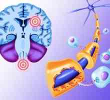 Patogenetske mehanizmi motnjah funkcije vida pri bolnikih z multiplo sklerozo