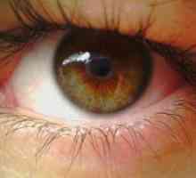 Pigmentnim degeneracija mrežnice zdravljenja oči