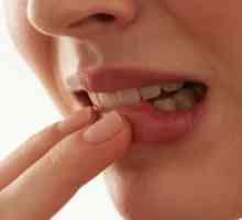 Ploščatoceličnega karcinoma ustne votline: zdravljenje, simptomi, prognoza