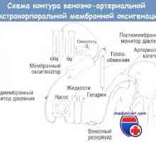 Zapleti zunajtelesni membranski oksigenacijo (ECMO)