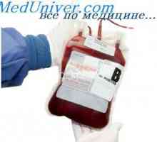 Indikacije in kontraindikacije za transfuzije rdečih krvnih celic pri novorojenčkih
