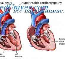 Pretok krvi v mišicah. Hipertrofija srca med vadbo