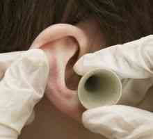 Poraz uho: ob prejemu droge s herpes zoster