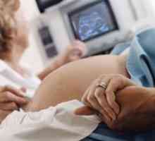 Trikuspidalne bolezen pri nosečnicah
