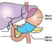 Posledice in zdravljenje raka želodca po operaciji
