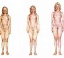 Prezgodnja puberteta pri ženskah: Znaki
