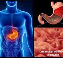 Vzroki kroničnega gastritisa