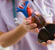 Znaki in simptomi bolezni srca pri ženskah