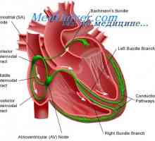 Srčno prevodnost sistem. sinusnega vozla