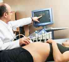 Molarna nosečnost v času nosečnosti, znaki, simptomi, vzroki, zdravljenje