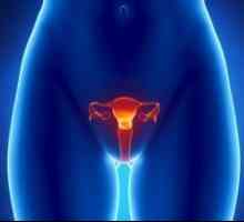 Vaginalni rak: simptomi, zdravljenje, oder, prognozo, simptomi