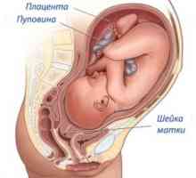 Maternični vrat pred rojstvom, simptomi, znaki
