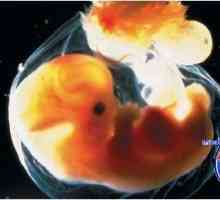 Reflekse zarodek. Mali možgani in njena funkcija pri plodu