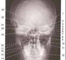 Lobanje rentgenski anatomijo