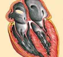 Restriktivno kardiomiopatijo