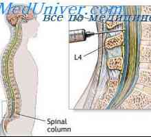 Cerebrospinalne sistem tekočine. Naloge likvorja