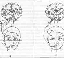 Vloga obraznega živca v manifestacije bolečine na obrazu