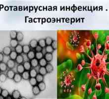 Rotavirus gastroenteritis