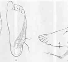 Brazgotina deformacija stopala in gležnja. napake Zdravljenje plantarna površine stopala