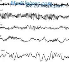 Možganski valovi in ​​ravni možganske aktivnosti. Elektroencefalogram (EEG) spanja
