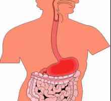 Simptomi gastroduodenita